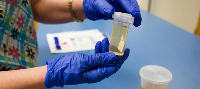 İş başvurularında yeni dönem: Şirketler uyuşturucu testi istemeye başladı - Resim : 3