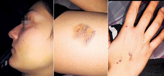 Severek evlendi, 2 ayda cehennemi yaşadı… - Resim : 3