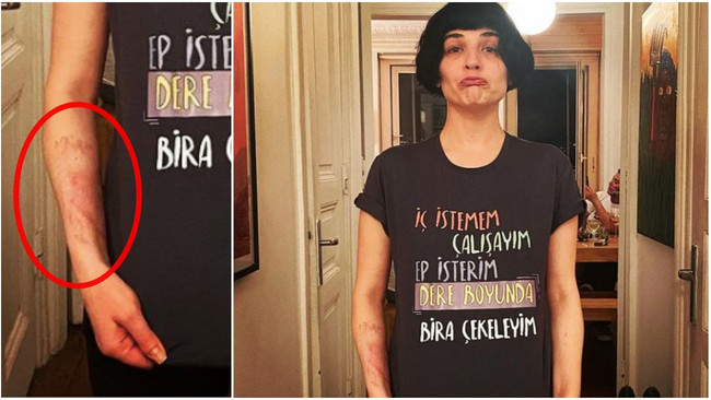 Gonca Vuslateri'den bir kötü haber daha! ‘İstanbul’u ayağa kaldırdım' - Resim : 1