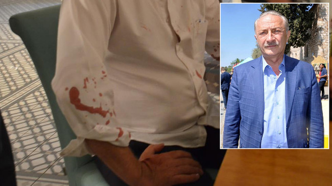 Didim belediye başkanına beyzbol sopalı saldırı!  Şüphelilerden biri yakalandı… - Resim : 2