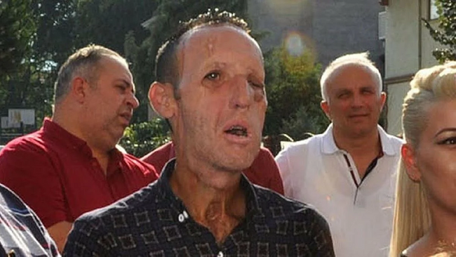 Uyuşturucudan gözaltına alınan Recep Sert'ten ilk açıklama - Resim : 2
