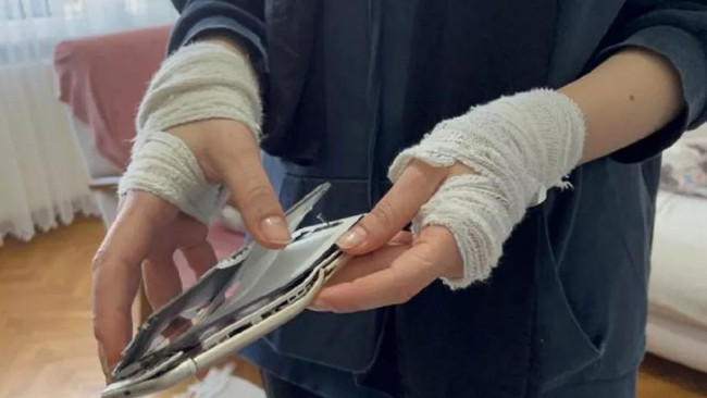 Tatile gittiği Karasu'da dehşeti yaşamıştı! Saldırganla ilgili yeni detaylar ve ifadesi ortaya çıktı - Resim : 3