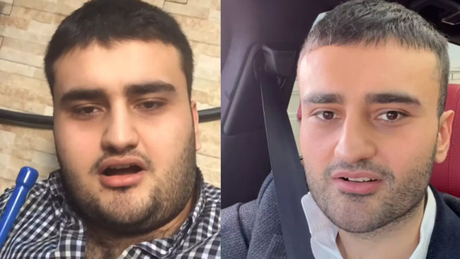 Hastaneye düşen CZN Burak son halini paylaştı - Resim : 1