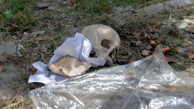 Sitenin çöpünden kafatası çıktı! Polisi alarma geçiren olay! - Resim : 3