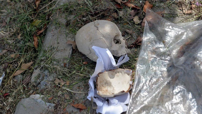 Sitenin çöpünden kafatası çıktı! Polisi alarma geçiren olay! - Resim : 4