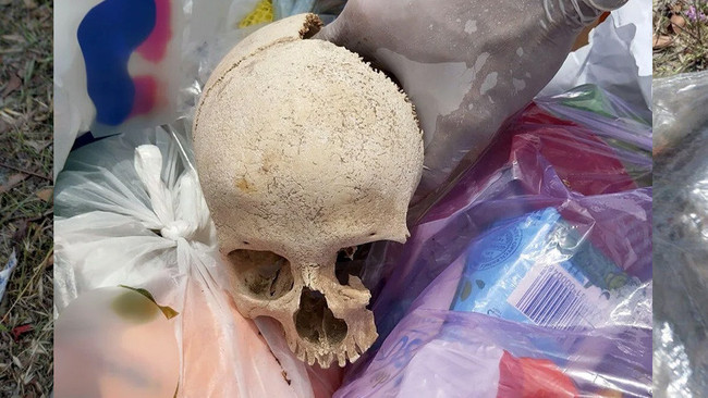 Sitenin çöpünden kafatası çıktı! Polisi alarma geçiren olay! - Resim : 2