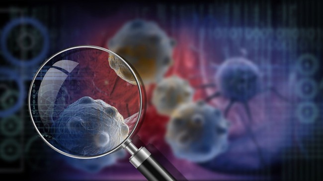 Rusya'da geliştirilen kanser aşısının insan klinik deneyleri başlıyor - Resim : 2