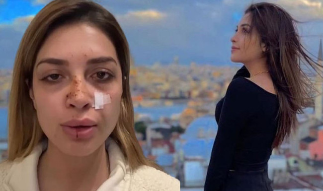 Ünlü şarkıcıya sokak ortasında şiddet! "Karakolda tehdit edildim" - Resim : 1