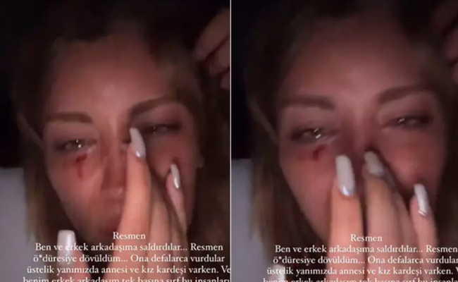 Mika Raun kanlar içinde fotoğrafını paylaştı! "Öldüresiye dövüldüm" - Resim : 1