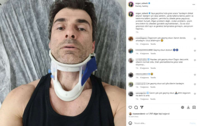 Ünlü oyuncu Özgür Özberk trafikte uyardığı şoför tarafından darbedildi: 'Bu ülkede şansa yaşıyoruz!' - Resim : 1