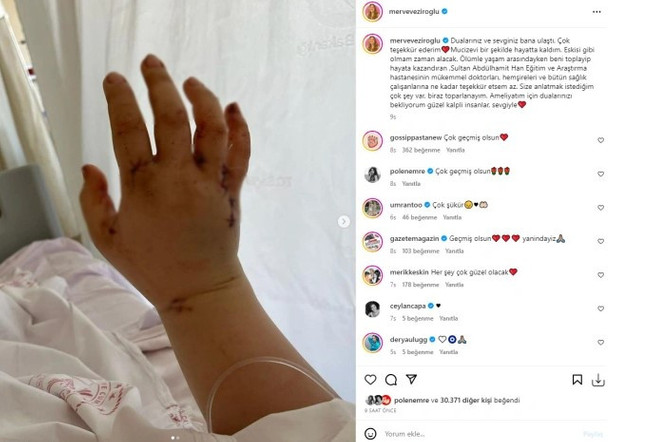 Eşi tarafından 32 yerinden bıçaklanan fenomen Merve Veziroğlu'ndan ilk paylaşım - Resim : 1