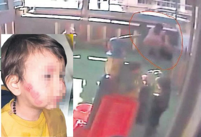 Kreşte dehşet! 17 aylık bebek kâbusu yaşadı! Görevlilerin yaptığı şoke etti - Resim : 1