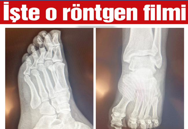 Özgür Özel’in ‘filmleri’ ortaya çıktı! ‘Vuruldu’ iddiası ortaya atılmıştı… - Resim : 1