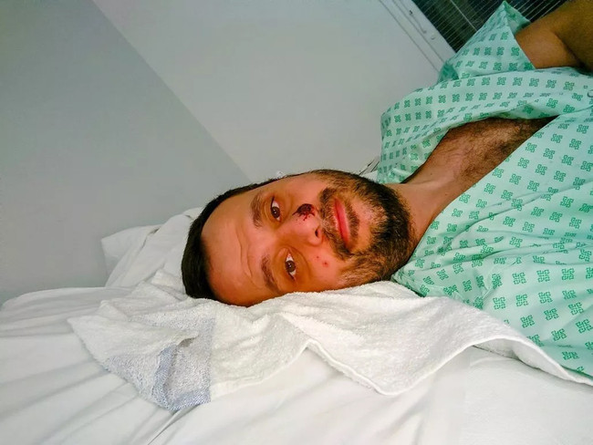 Maymun çiçeğine yakalanan Türk BM'nin sitesinde yayınlandı! "Sanırım öleceğim" - Resim : 1