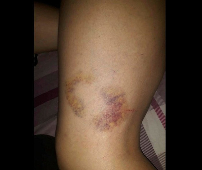 Severek evlendi, 2 ayda cehennemi yaşadı… - Resim : 6