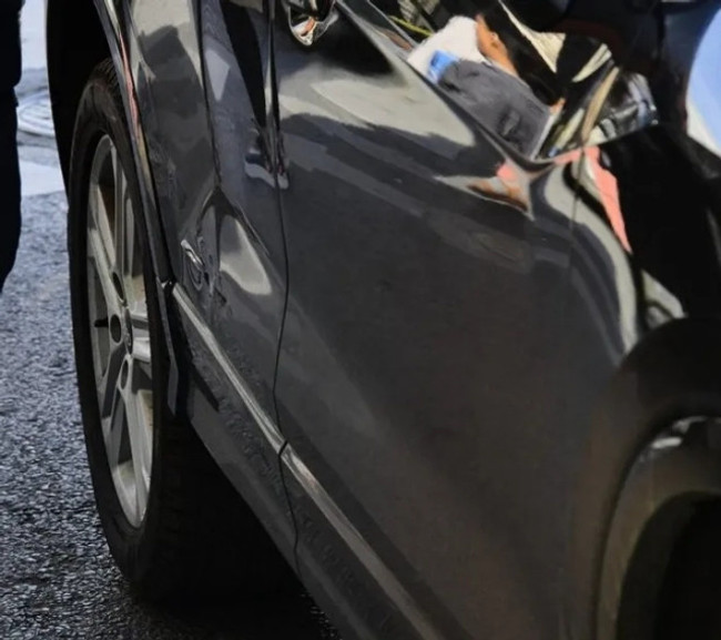 Ünlü oyuncu Hilal Altınbilek kaza geçirdi - Resim : 2