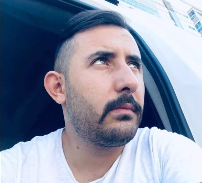 Eski nişanlısının yüzüne kimyasal madde atıp kaçtı - Resim : 1