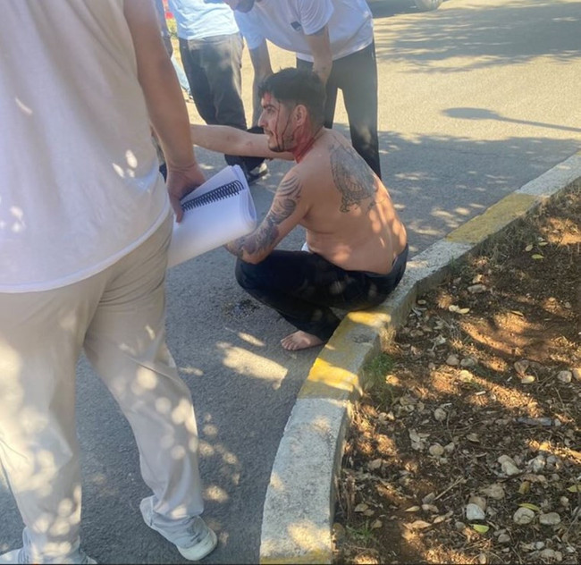 "Kıyma" setine silahlı saldırıda "Daltonlar" detayı - Resim : 1