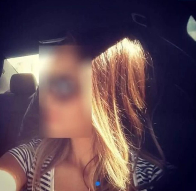 Meslektaşını darbetti, polisin başı yarıldı! "Kaç para istiyorsunuz aç köpekler" - Resim : 3