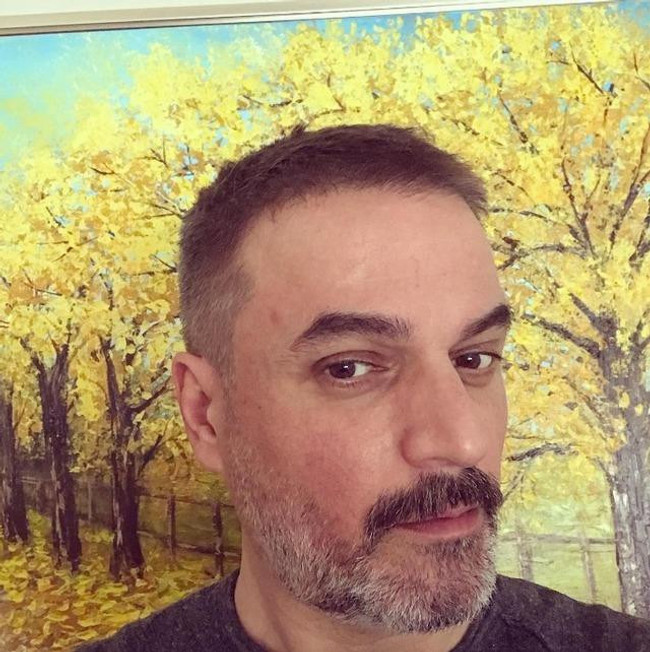 Organ nakli bekleyen Ufuk Özkan'dan yeni paylaşım: “Hastalığım ile alakalı…” - Resim : 2