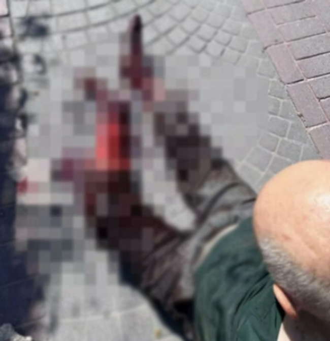 İstanbul'da başıboş köpek dehşeti! Yaşlı adam kanlar içinde kaldı - Resim : 1