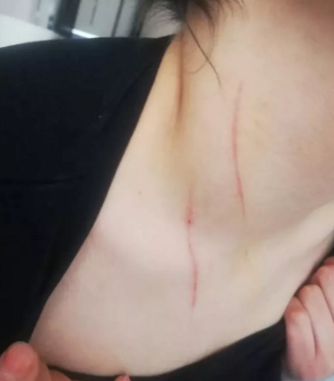 Kadını zorla otele götürüp dehşeti yaşatmışlardı! Kan donduran olayda karar verildi - Resim : 1