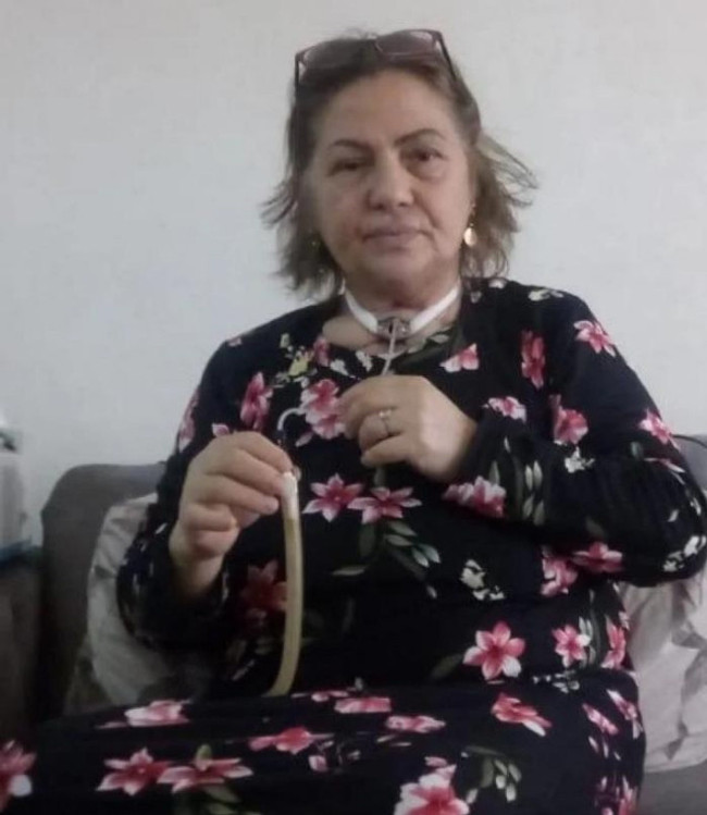 Gırtlak kanseriyle mücadele eden Tüdanya'dan iyi haber - Resim : 1