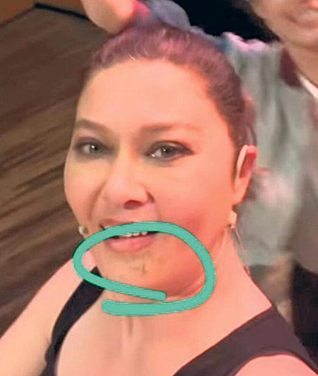 Nurgül Yeşilçay sette kaza yaptı! Fren yerine gaza basmış - Resim : 2