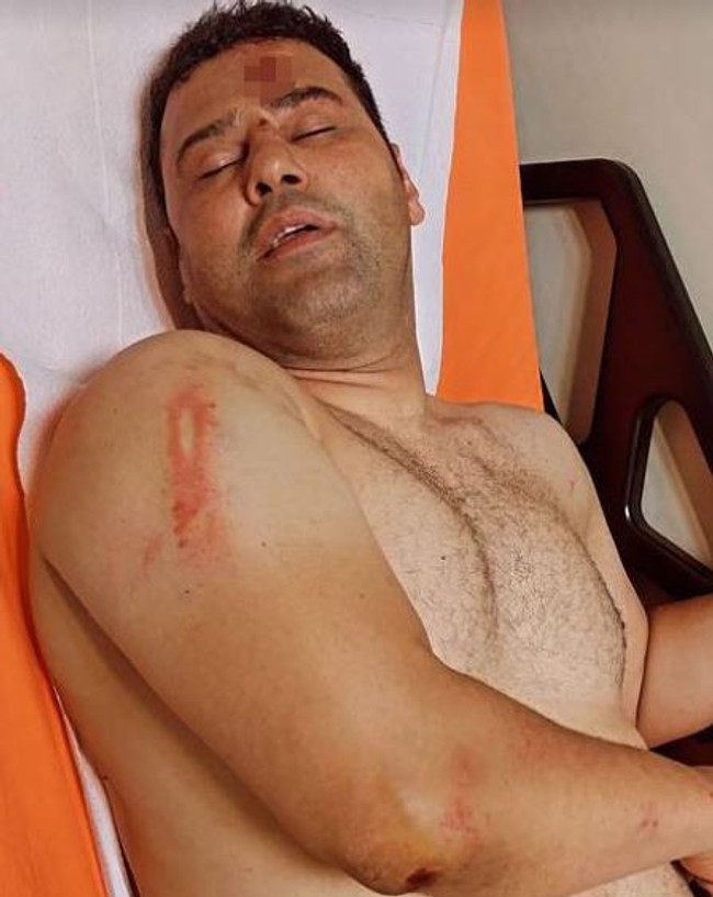 Survivor yarışmacısı, başcazgırı hastanelik etti! - Resim : 2