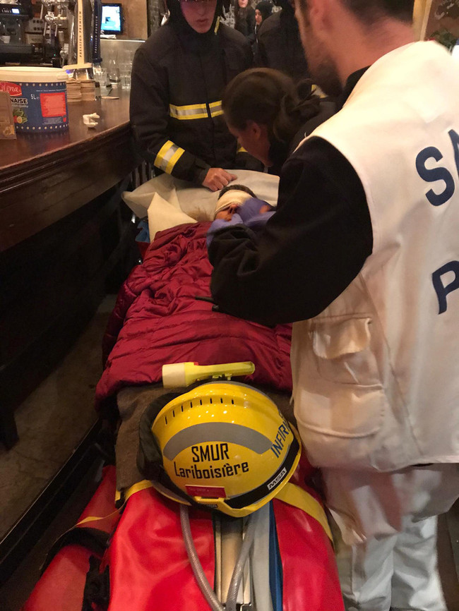 Polis gaz kapsülü attı, AA foto muhabirini gözünden yaralandı! - Resim : 2