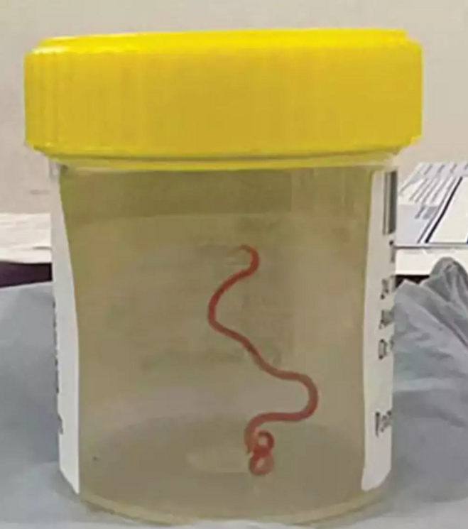 Depresyon diye gitti, beyninden bakın ne çıktı! - Resim : 1