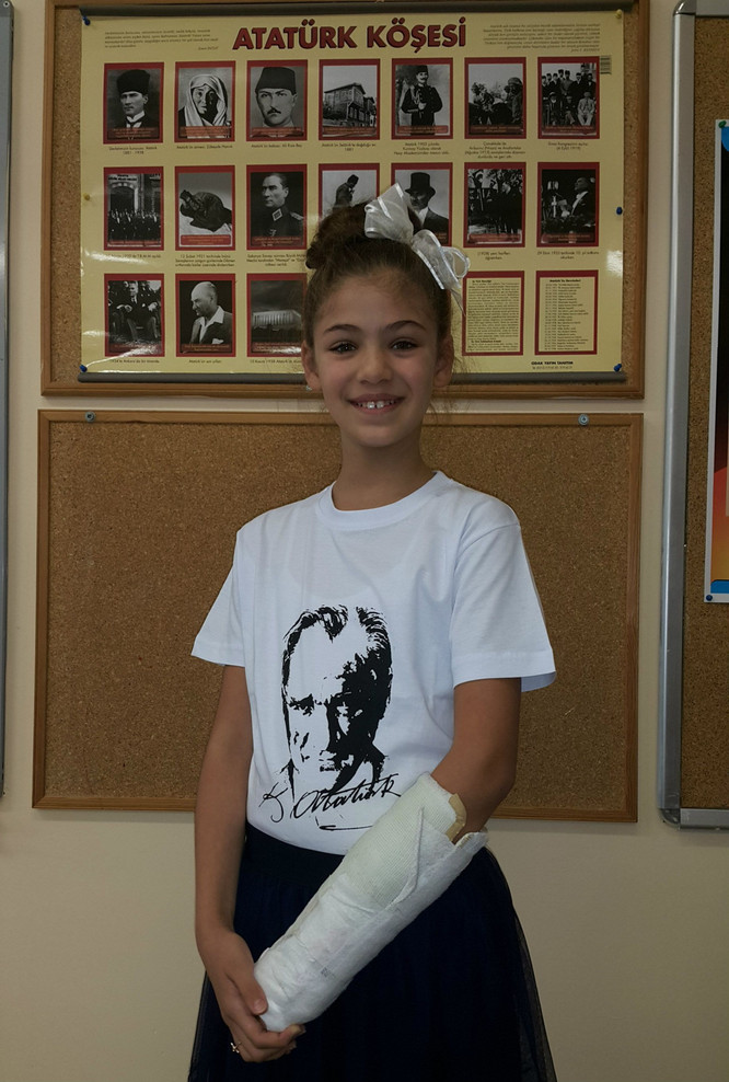 Genç oyuncunun kolu kırıldı, seti bırakmadı! - Resim : 1