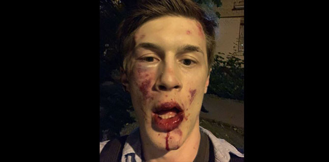 Gazeteciyi evinin önünde öldüresiye dövdüler! - Resim : 1