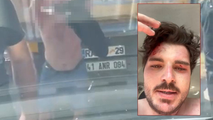 Oyuncu Mehmet Akif Akdeniz TEM’de darp edildi: “Beni öldüresiye dövdüler” - Resim : 1
