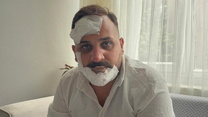 Eski sözlüye, polislerden öldüresiye dayak: 'Sülaleni öldürürüz' - Resim : 1