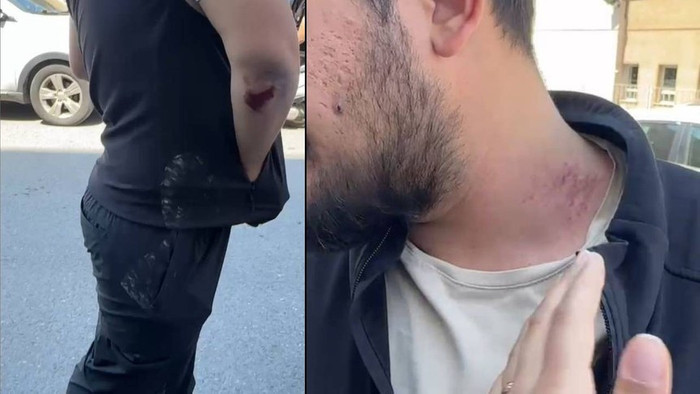 Kadın muhabire ve kameramana tekme tokat saldırı! - Resim : 1