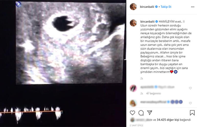 Bircan Bali müjdeyi verdi: Çok küçük bir mucizeyle beraberim! - Resim : 1