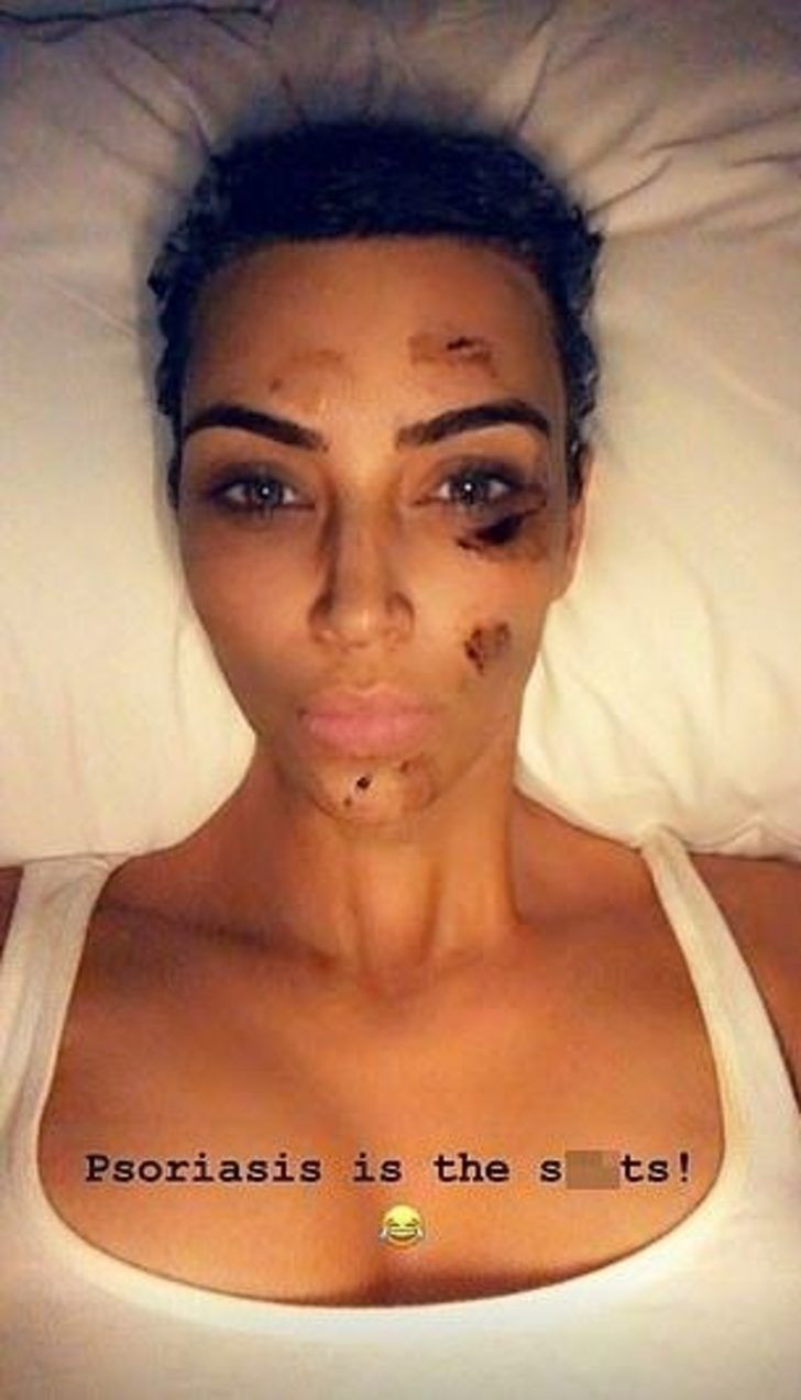 Sosyal medya sallandı! Kim Kardashian'a ne oldu? - Sayfa 3