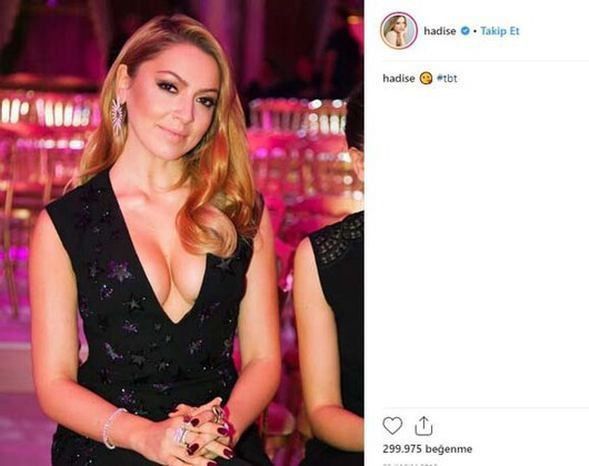 Hadise derin dekolteli paylaşımıyla olay oldu - Sayfa 2