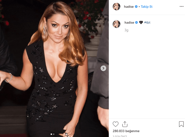 Hadise Instagram hesabından meydan okudu! - Sayfa 2