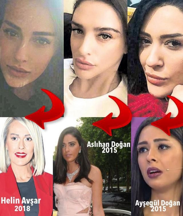 Ünlüler arasında yeni trend Aslıhan Doğan'a benzemek - Sayfa 7