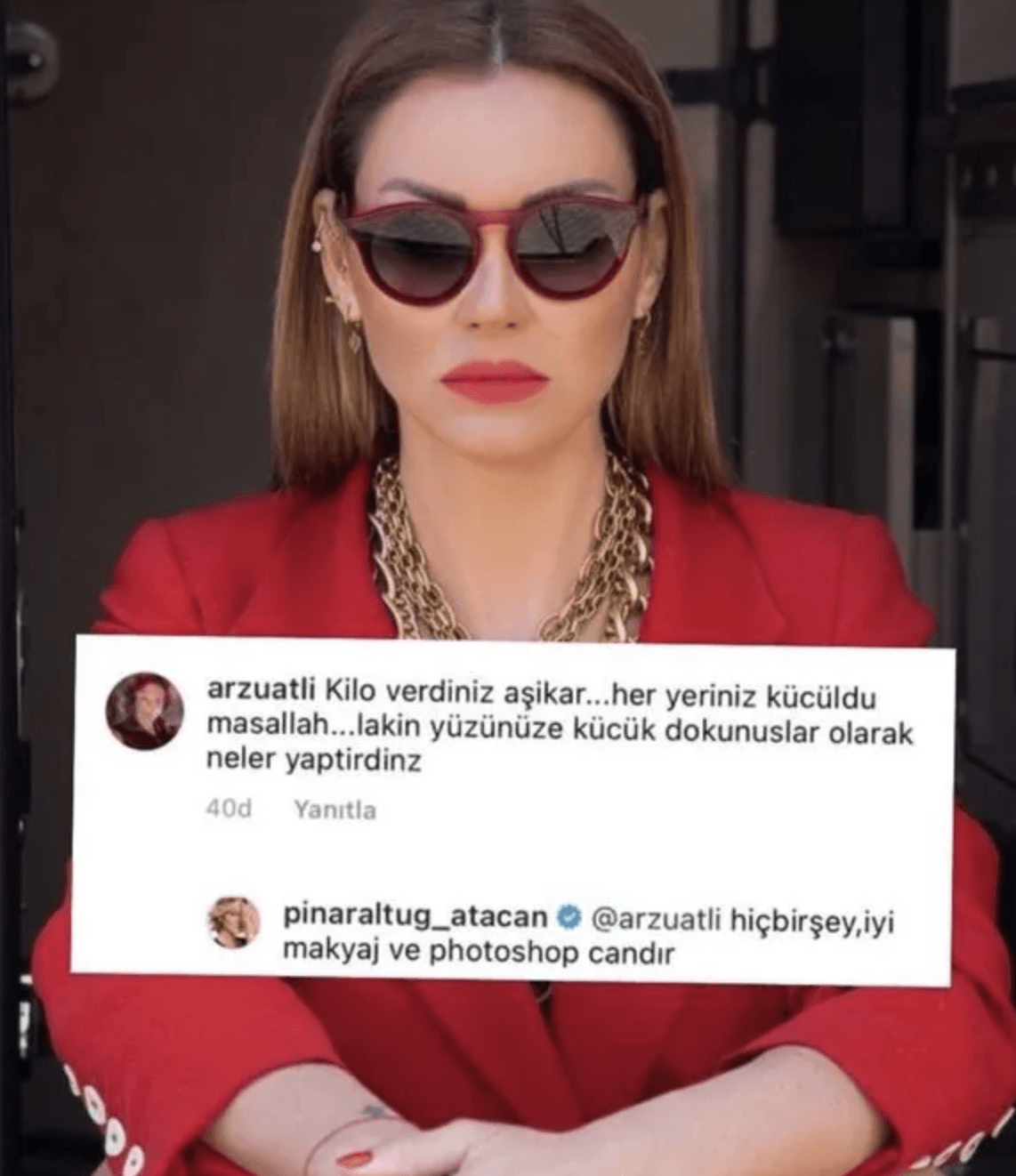 Takipçisinin sorusuna Pınar Altuğ'dan beklenmedik itiraf! - Sayfa 6