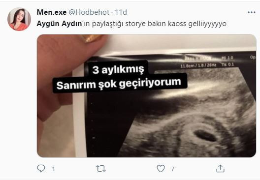 Aygün Aydın'dan şok hamilelik paylaşımı! Sosyal medya sallandı - Sayfa 7