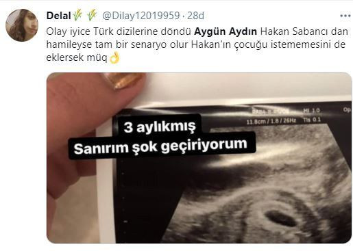 Aygün Aydın'dan şok hamilelik paylaşımı! Sosyal medya sallandı - Sayfa 10