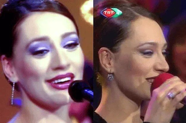 Yerli Angelina Jolie denilen Umut Akyürek'in estetiksiz hali ağızları açık bıraktı! - Sayfa 12