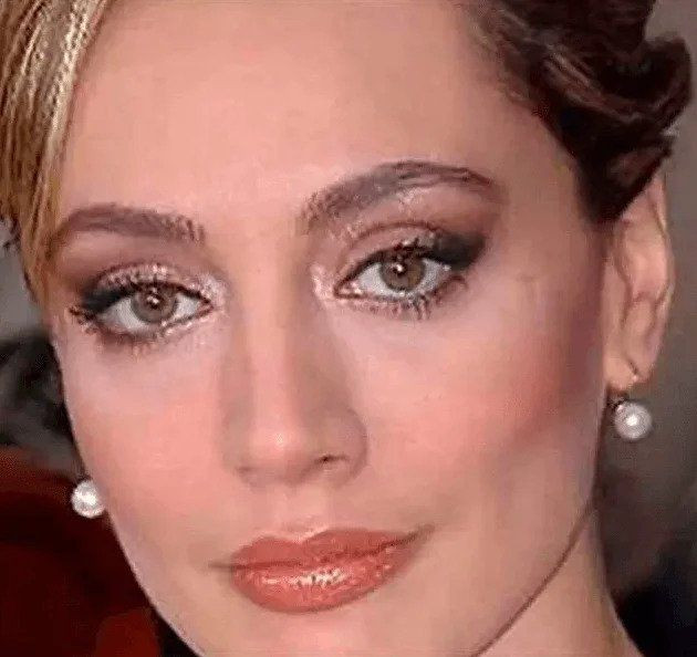 Yerli Angelina Jolie denilen Umut Akyürek'in estetiksiz hali ağızları açık bıraktı! - Sayfa 14