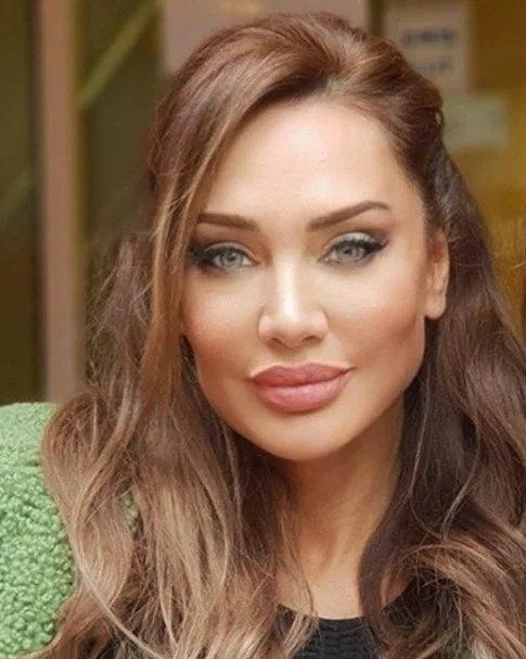 Yerli Angelina Jolie denilen Umut Akyürek'in estetiksiz hali ağızları açık bıraktı! - Sayfa 27