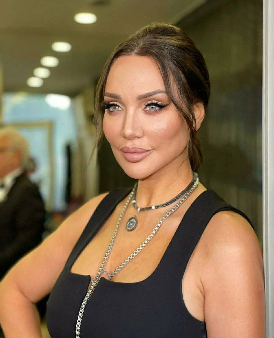 Yerli Angelina Jolie denilen Umut Akyürek'in estetiksiz hali ağızları açık bıraktı! - Sayfa 32