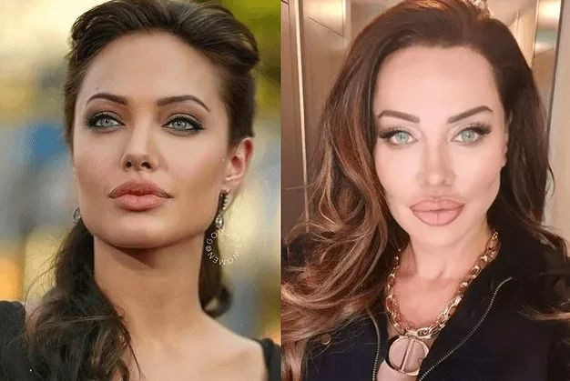 Yerli Angelina Jolie denilen Umut Akyürek'in estetiksiz hali ağızları açık bıraktı! - Sayfa 18