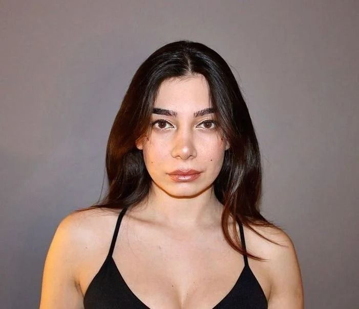 Alemin Kralı'nın 'Oben'i Birsu Demir'in son hali şoke etti! Seksi şarkıcı Dua Lipa'ya benzetildi - Sayfa 22